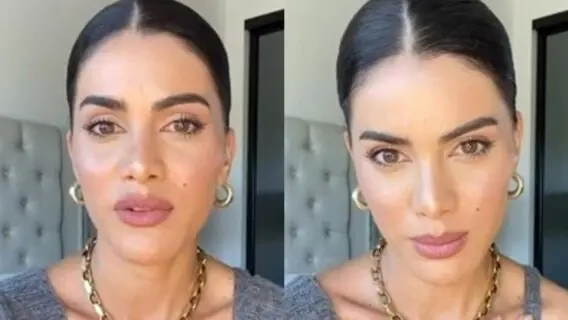 Camila Coelho desabafa sobre epilepsia; entenda a doença