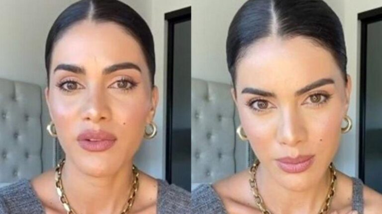 Camila Coelho desabafa sobre epilepsia; entenda a doença