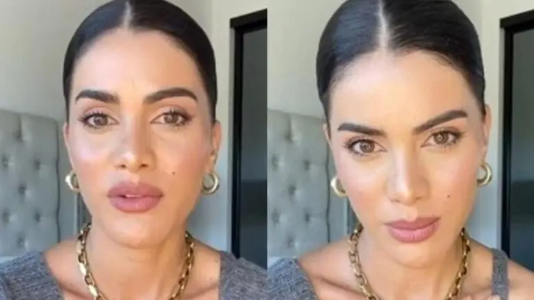 Camila Coelho desabafa sobre epilepsia; entenda a doença