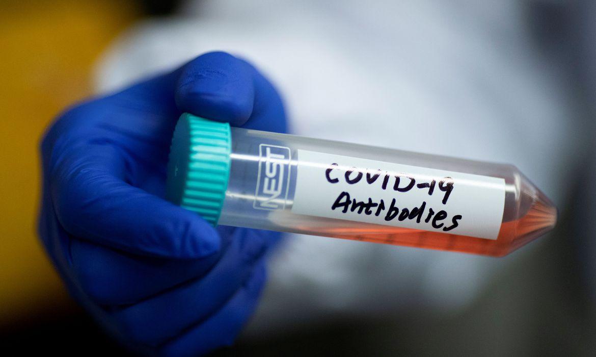 Cientistas descobrem anticorpos que neutralizam coronavirus eua