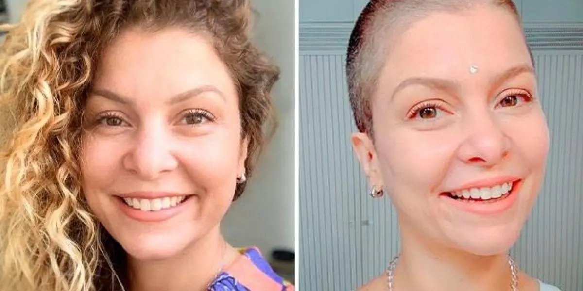 Bárbara Borges em duas fotos: antes, com os cabelos loiros cacheados, e depois ao raspar os fios