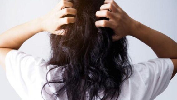 Conheça 5 mitos sobre a caspa e saiba como se livrar do problema