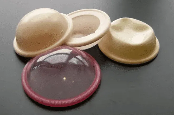 Foto mostra diafragma, contraceptivo feminino.