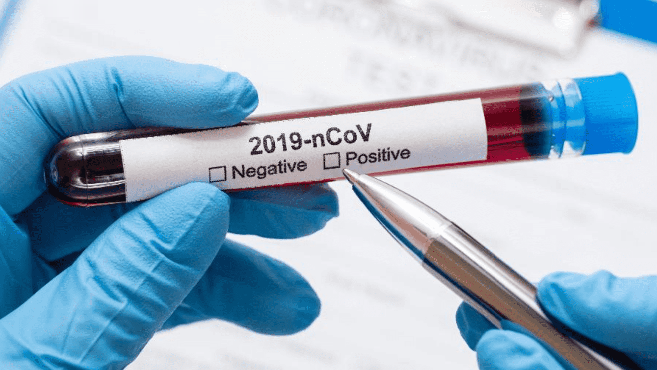 Foto mostra uma mão segurando amostra de sangue para teste de coronavírus