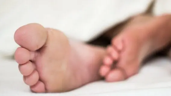 Micose nos pés: saiba como prevenir e cuidar dos pés no inverno