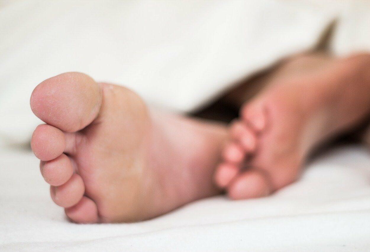 micose nos pés