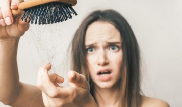 queda de cabelo