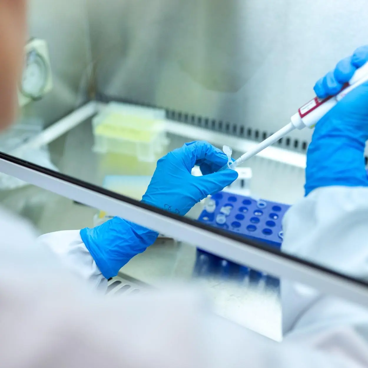 vacina russa contra covid 2