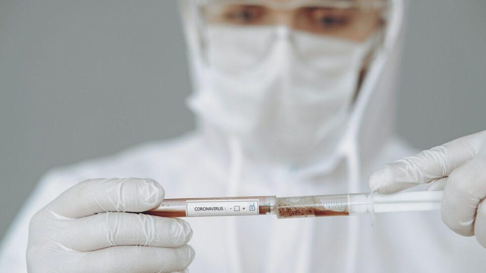 estudo de anticorpos