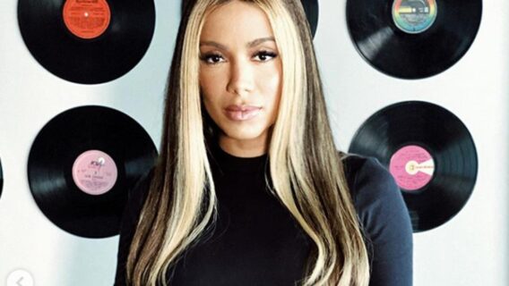 Mecha frontal: moda dos anos 90 volta com tudo