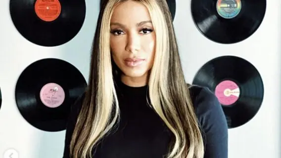 Mecha frontal: moda dos anos 90 volta com tudo