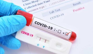 Reinfecção por Covid-19