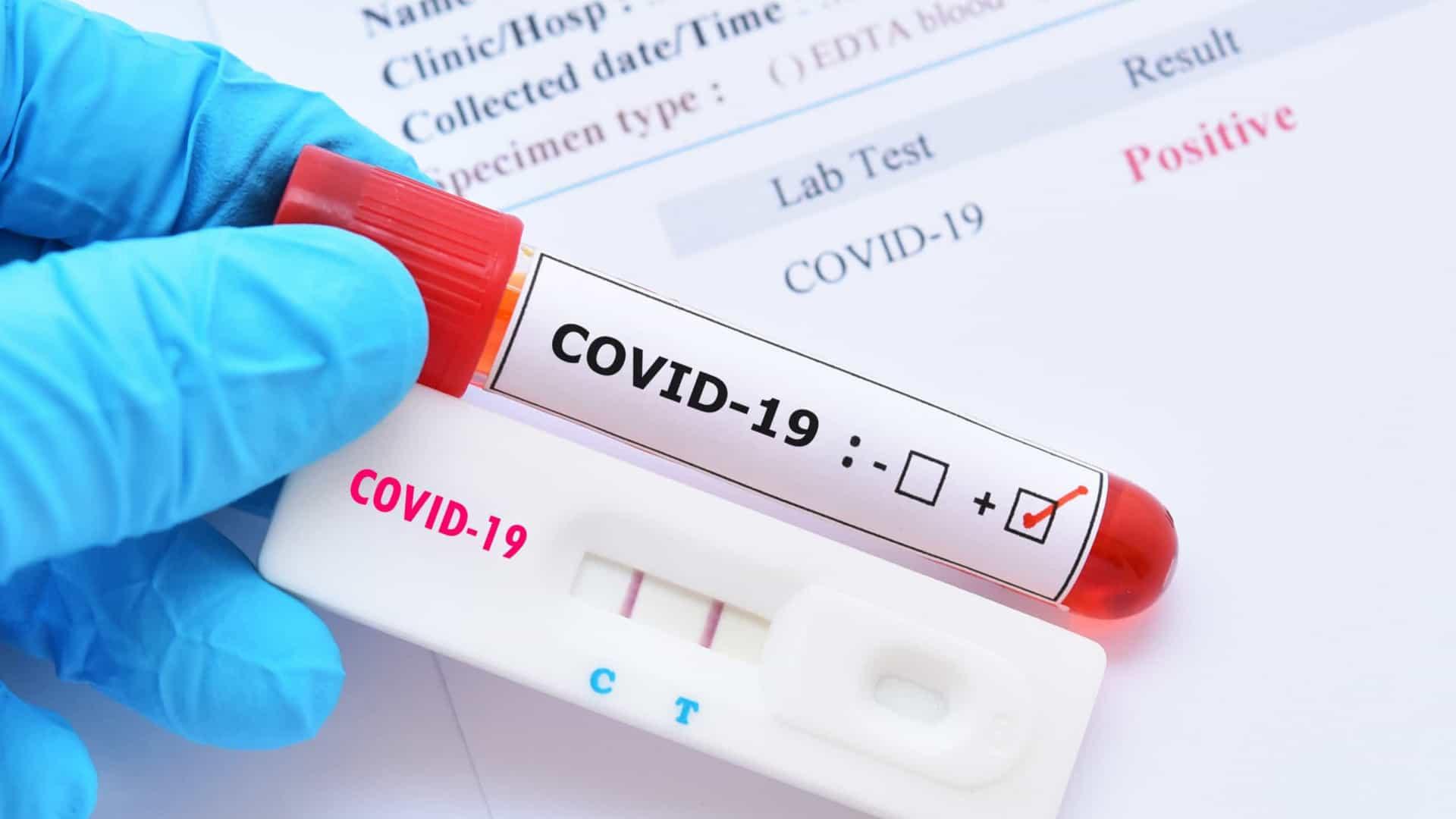Reinfecção por Covid-19