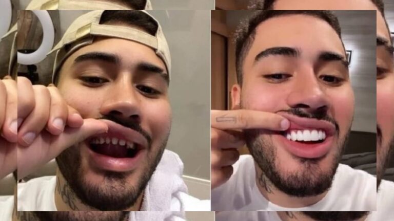 Veja memes de Kevinho após aparecer sem lente de contato nos dentes