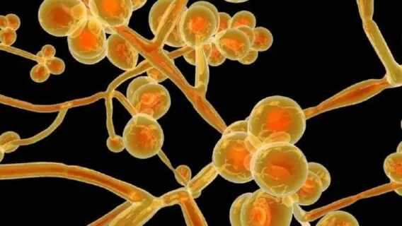 Brasil investiga 1°caso de fungo fatal super-resistente a medicamentos