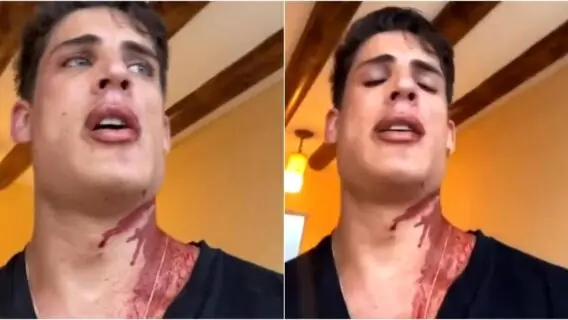 Thiago Ramos, namorado da mãe de Neymar, é esfaqueado em Cancún