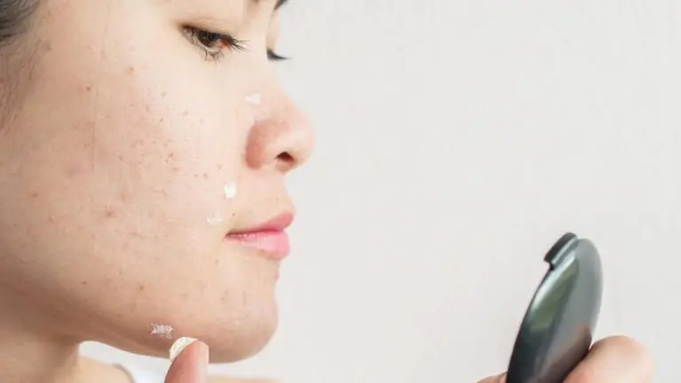 Pele com acne: aprenda os principais cuidados durante o verão 