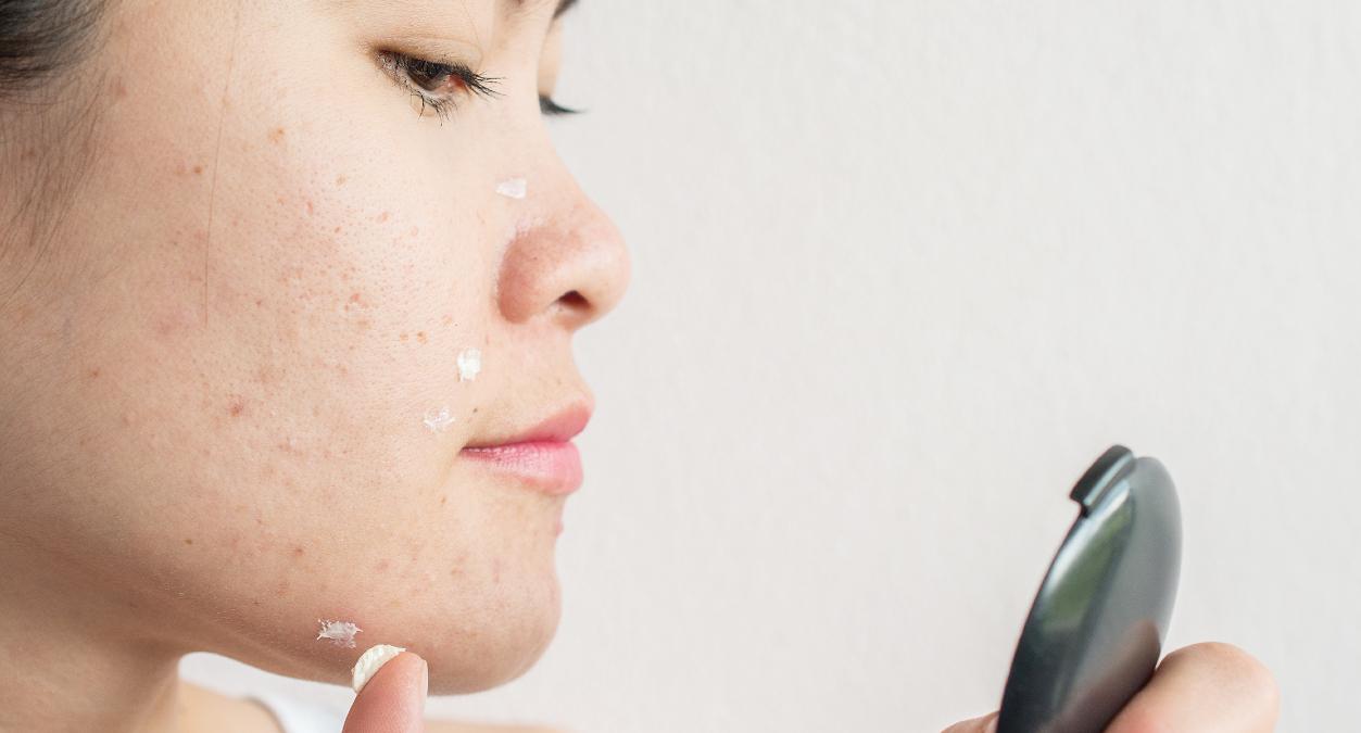 pele com acne