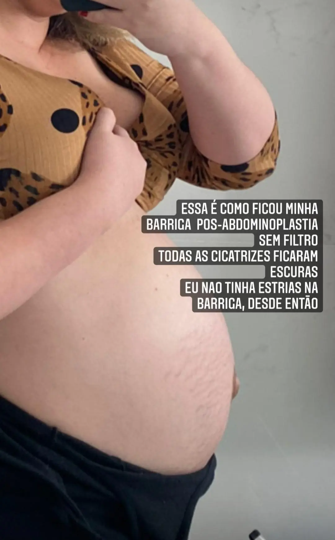 Imagem mostra corpo da cantora Marilia Mendonça