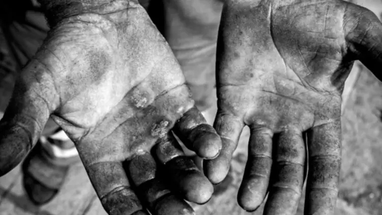 Como denunciar trabalho escravo no Brasil?