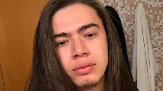 Whindersson Nunes mostra sua versão ‘falido’ após quebrar dente