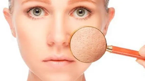 Poros abertos: por que surgem, dicas para evitar e melhores produtos 