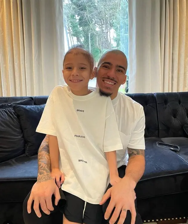 alopecia