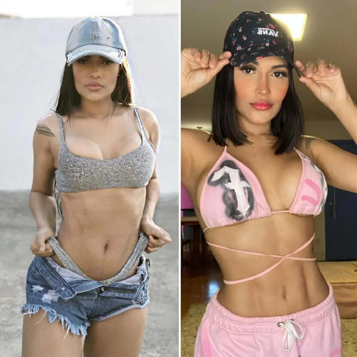 Flay fez Lipo LAD das famosas