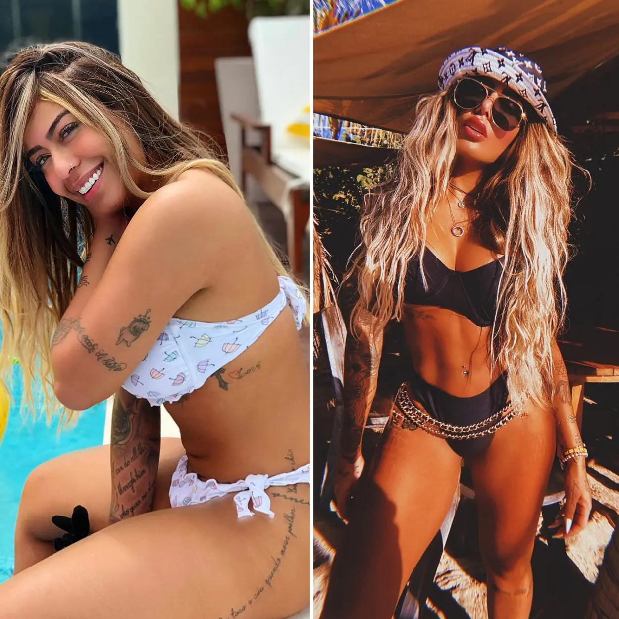 Lipo LAD das famosas