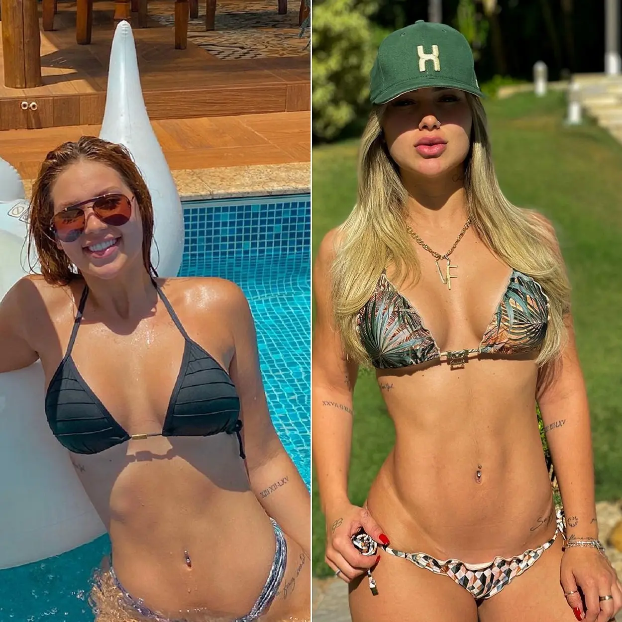 Lipo LAD das famosas