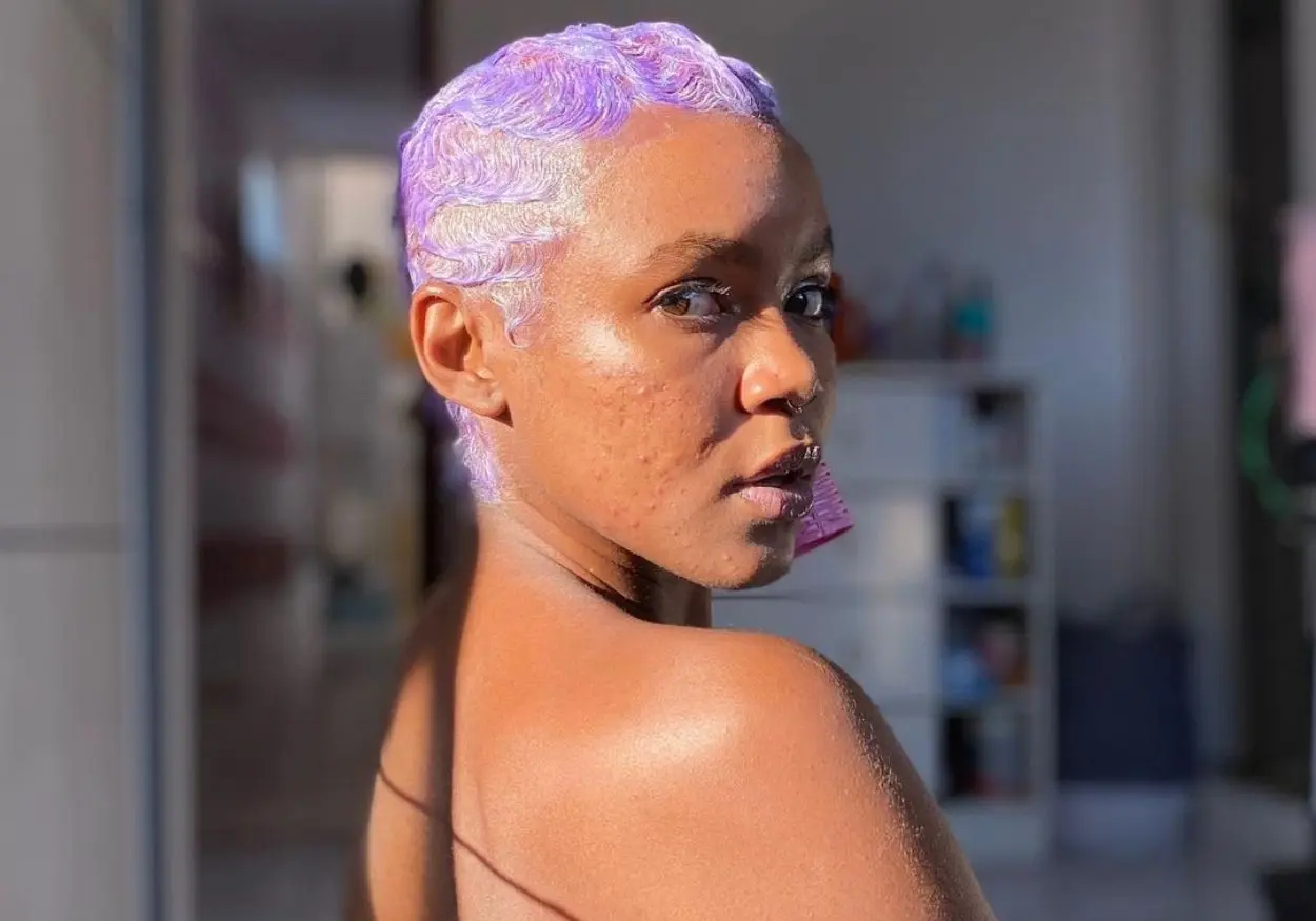 Pele livre: melhores influenciadoras do movimento Skin Positivity
