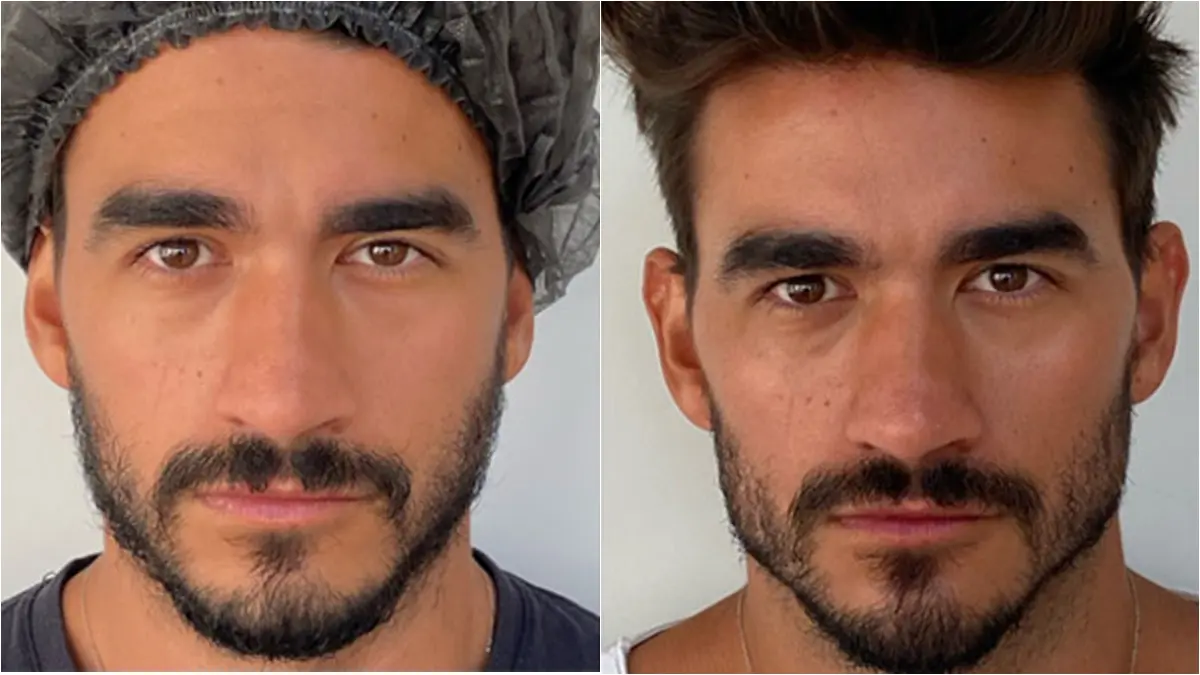 participantes No Limite