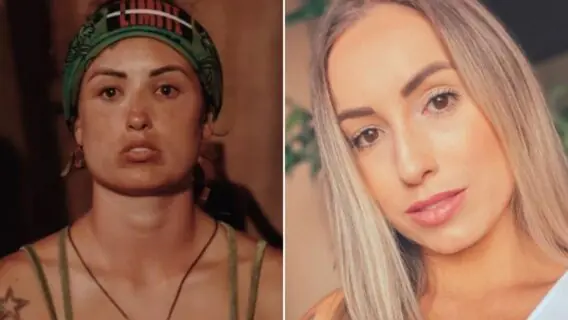 No Limite: equipe explica inchaço no rosto de Jéssica