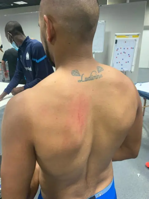 Payet ficou com marcas da confusão entre Nice x Marselha