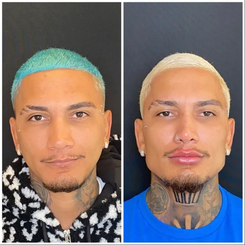 dynho antes e depois