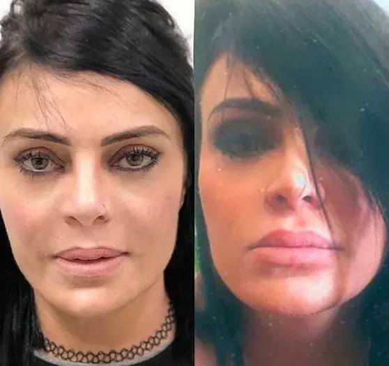 antes e depois de Valentina Francavilla