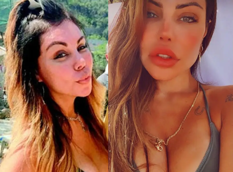 liziane gutierrez antes e depois