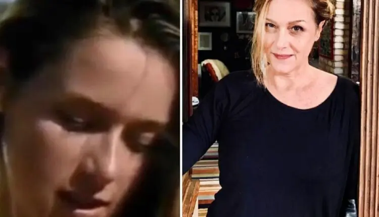 Gisela antes e depois Gisela antes e depois