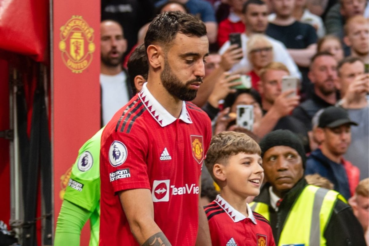 Onde assistir jogo do Manchester United hoje ao vivo (27/8)