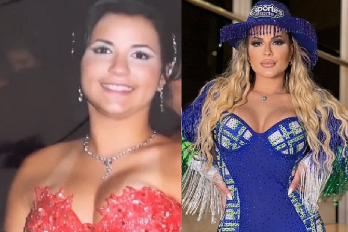 Antes e depois: Deolane Bezerra abre o jogo sobre cirurgias