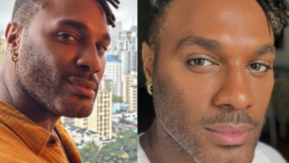 Fred Nicácio é gago desde a infância; entenda o distúrbio na fala