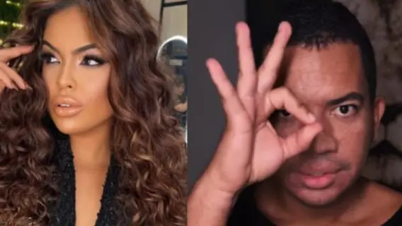 Harmonização facial e botox: o antes e depois de Paula e Bruno do BBB 23