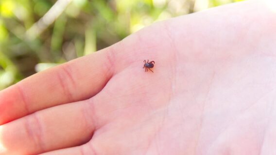 Febre maculosa passa de pessoa para pessoa?