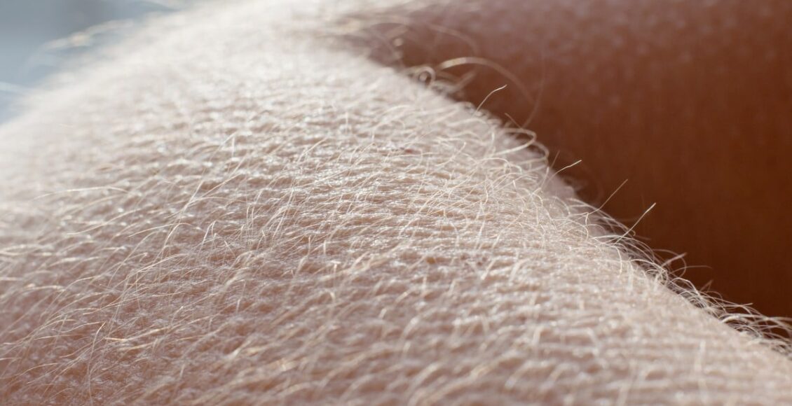 frio os pelos crescem mais rápido