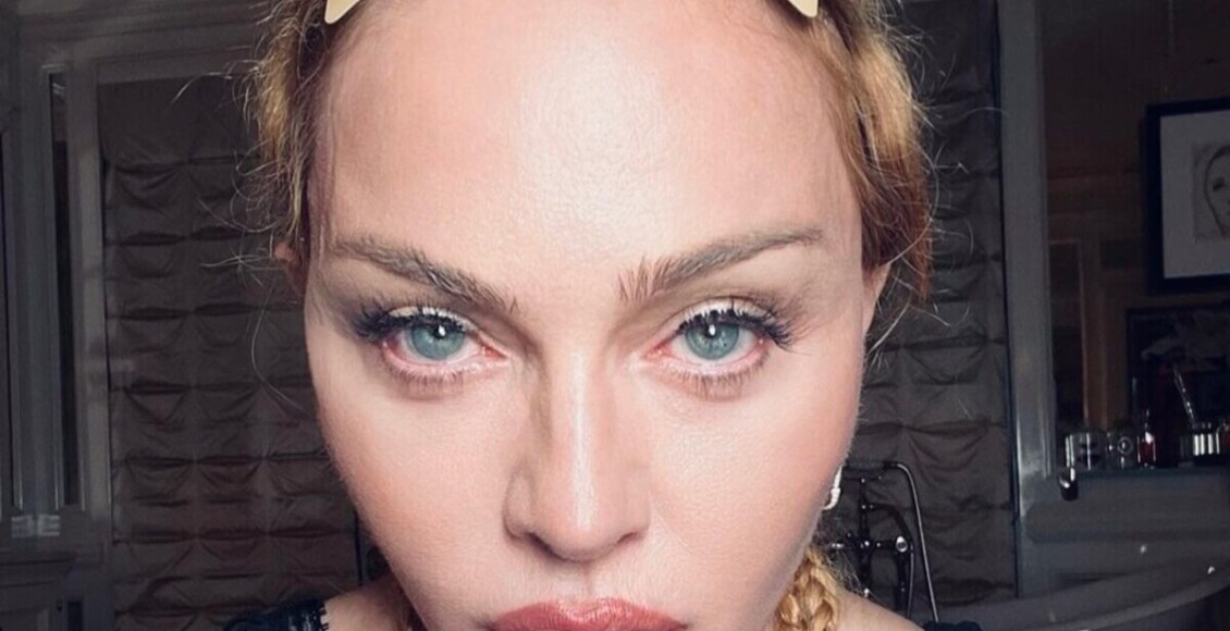 o que aconteceu com Madonna