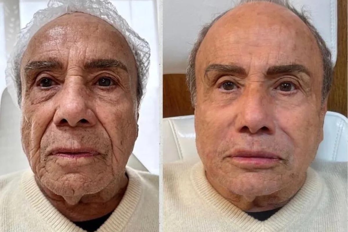 Stênio Garcia harmonização