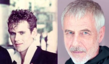 antes e depois Ritchie