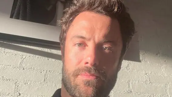 O que aconteceu com Kayky Brito: ator foi atropelado e estado é grave