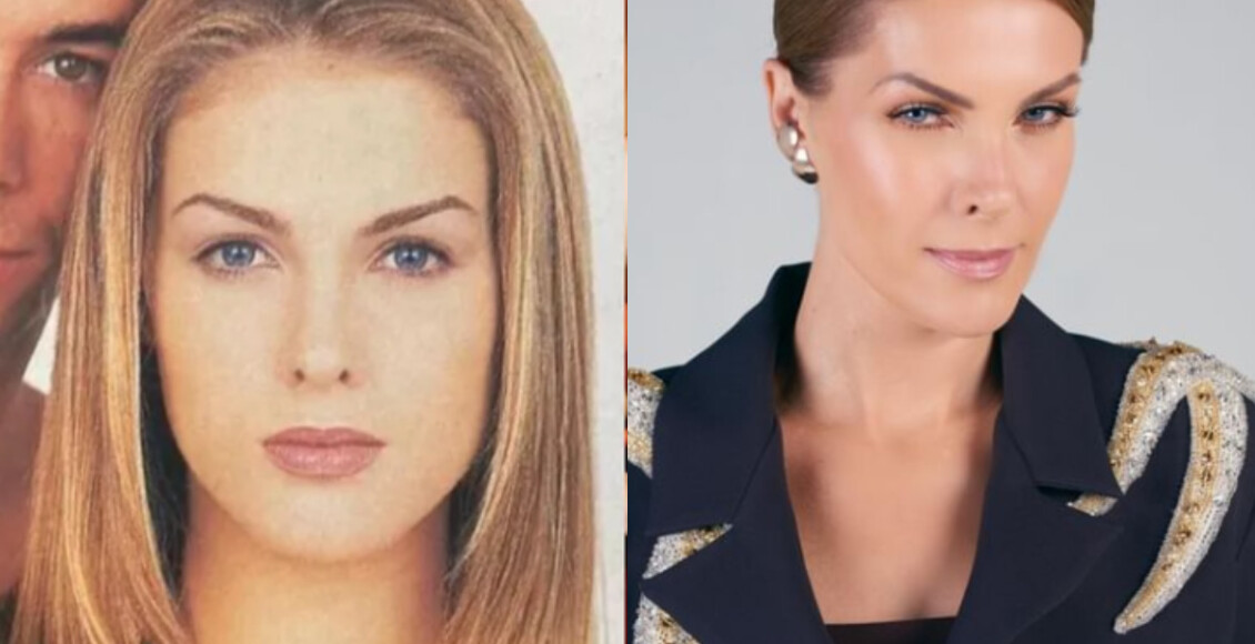 ana hickmann antes e depois