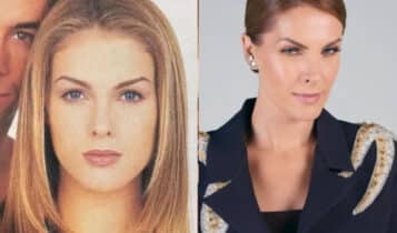 Ana Hickmann antes e depois: veja a ex-modelo no começo da carreira ana hickmann antes e depois